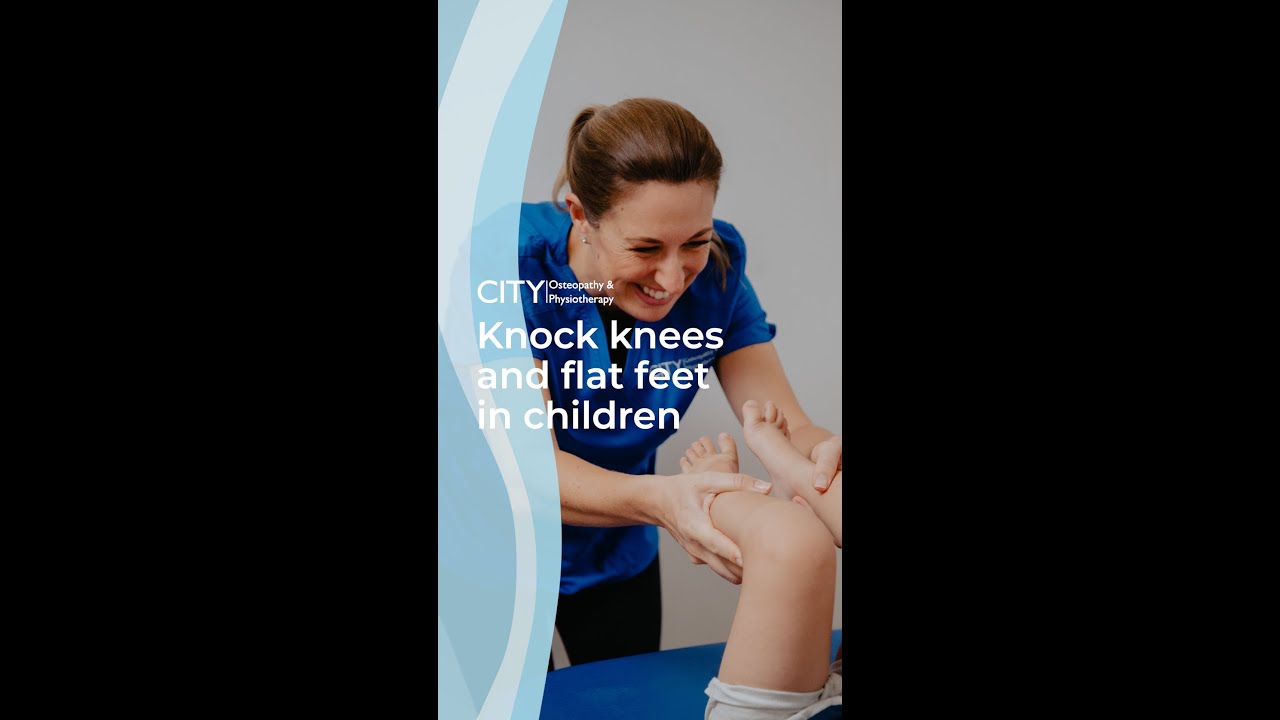 Knock knees and flat feet in children | City Osteopathy & Physiotherapy