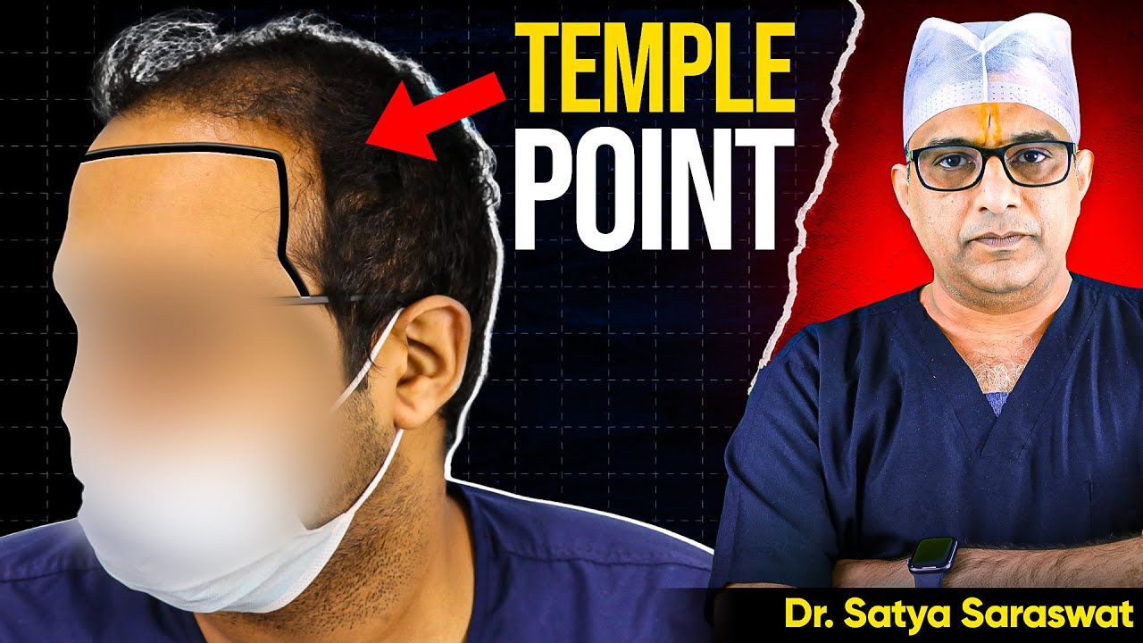 Challenges in Temple Point Hair Transplant - By Dr Satya Saraswat, Hair Transplant Surgeon