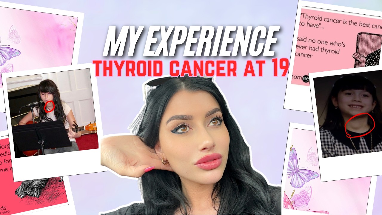 Life after Thyroidectomy/Thyroid Cancer (16 months)