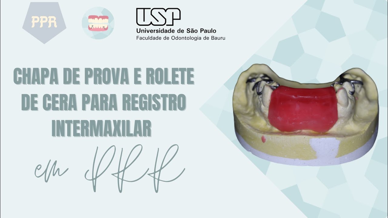 Chapa de prova e rolete de cera para registro intermaxilar em PPR