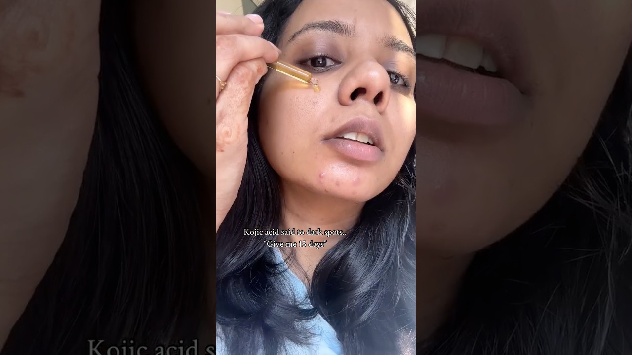 Derma Co Kojic Acid Brightening Serum Review | Dark Spots | Uneven Skin Tone