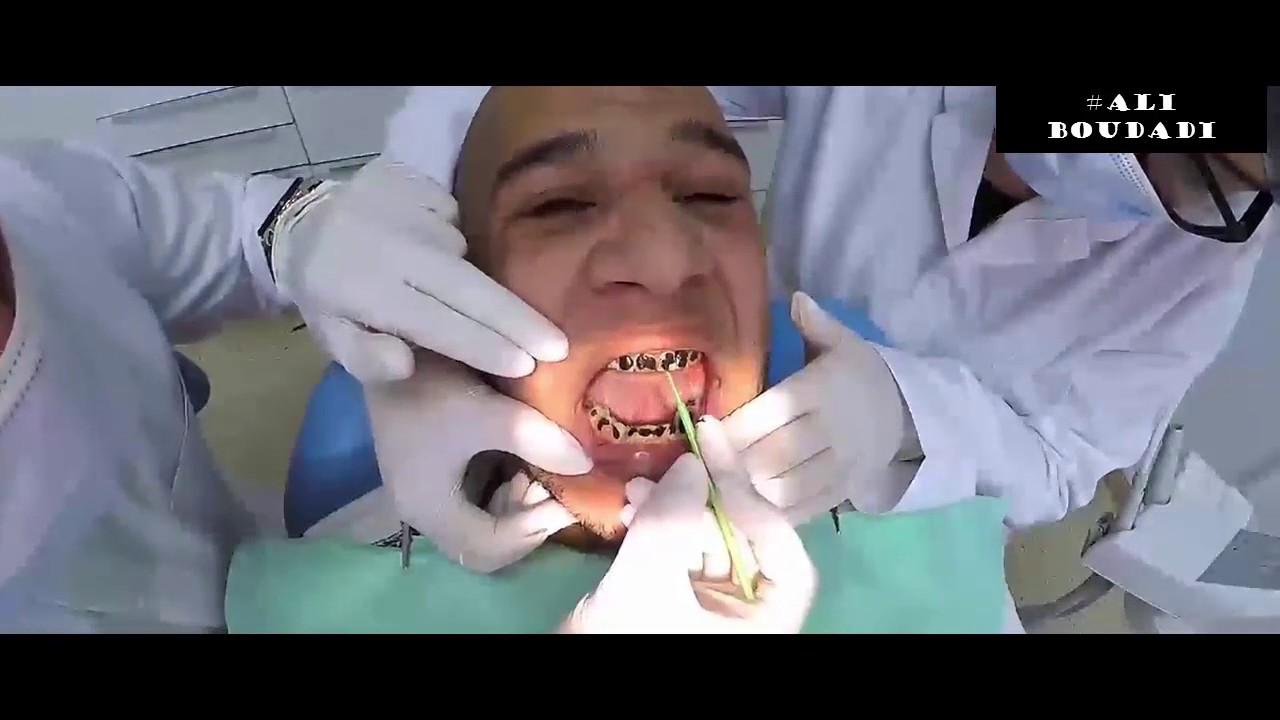 mister ab camera cach&eacute; جديد ميستر آبي  كاميرا مخفية 2017 wa3ra