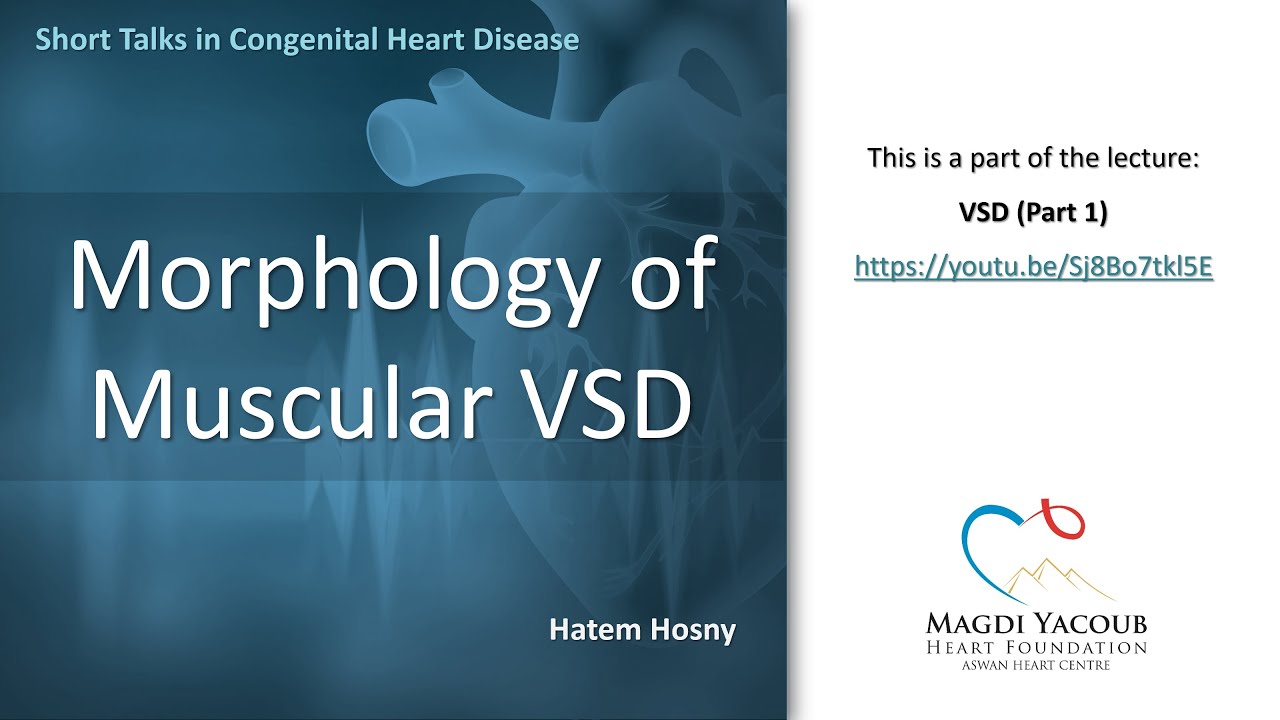 Morphology of Muscular VSD - Hatem Hosny