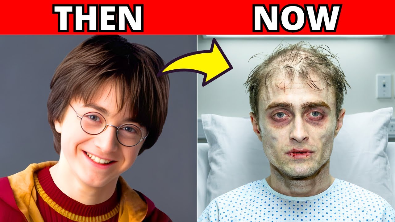 HARRY POTTER STARS SHOCKING TRANSFORMATION &ndash; THEN VS NOW