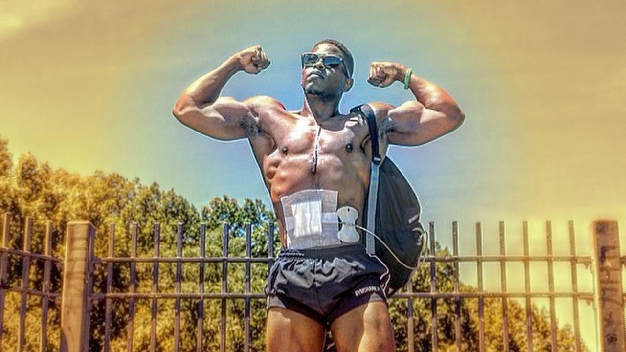 “Heart in Backpack” Fitness Star Gets a Transplant!