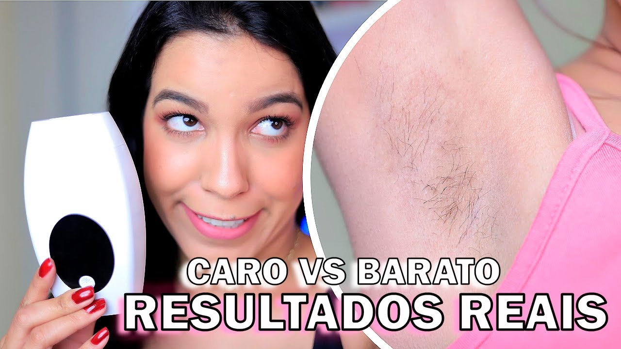 RESULTADO DEPILADOR LUZ PULSADA CHINA (