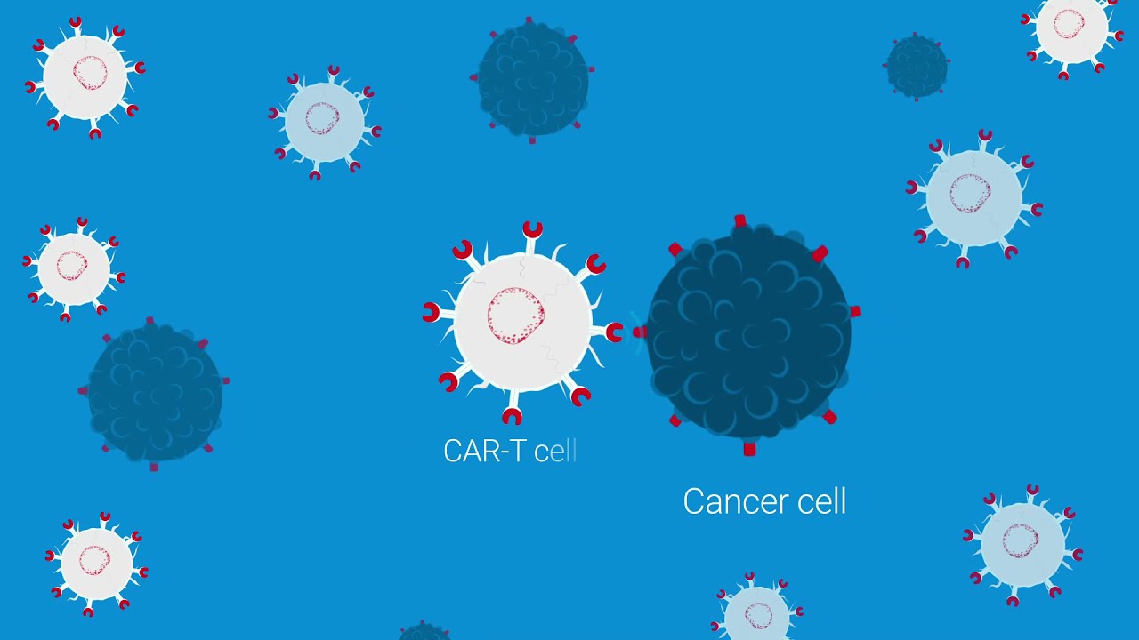 Maximize CAR-T Killing of Cancer Cells with the xCELLigence Real Time Cell Analysis (RTCA) eSight