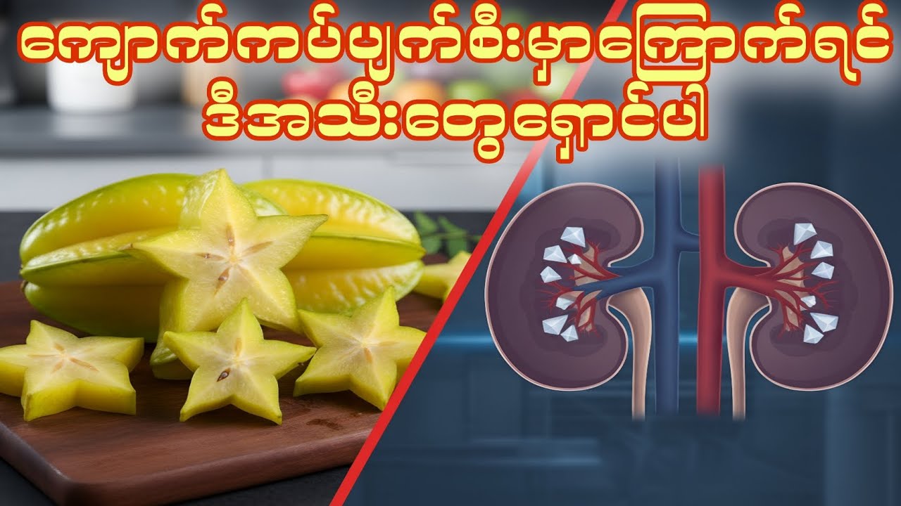 တကယ်တမ်း သင်ကျန်းမာတယ်ထင်ပြီး စားနေတဲ့ အစားအစာက သင့်ကျောက်ကပ်အတွက် အဆိပ်ဖြစ်နေနိုင်ပါတယ် #kidney 