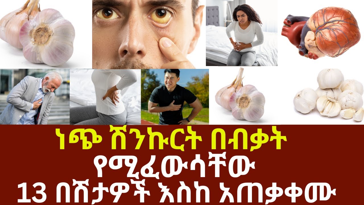 ነጭ ሽንኩርት በብቃት የሚፈውሳቸው 13 በሽታዎች እስከ አጠቃቀሙ  መጠቀም የሌለበትስ ሰው አለ? |  #drhabeshainfo #garlicbenefit