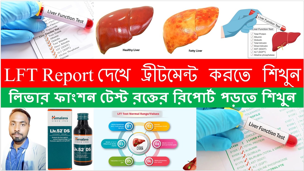 LFT Blood Report | Liver Function Test | Bong Pharma