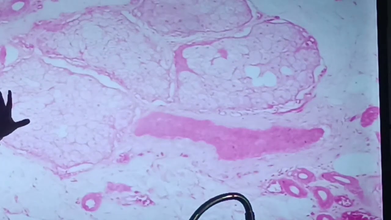 HISTOLOGIA TEJIDO EPITELIAL GLANDULAR - ucsur