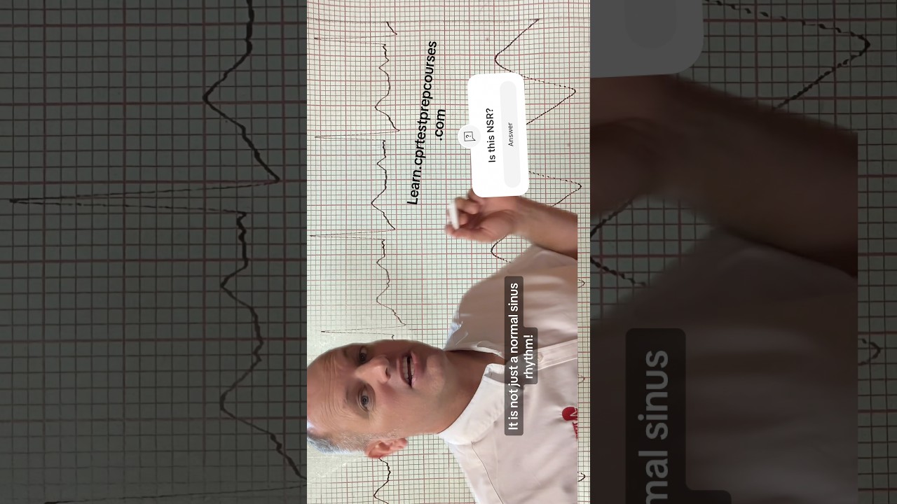 Normal Sinus Rhythm or is it a heart block? #ACLS #aclstestprepcourse #pals #palstestprepcourse