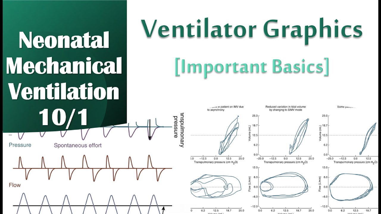 Neonatal Mechanical Ventilation 10/1 | Graphics (overview)