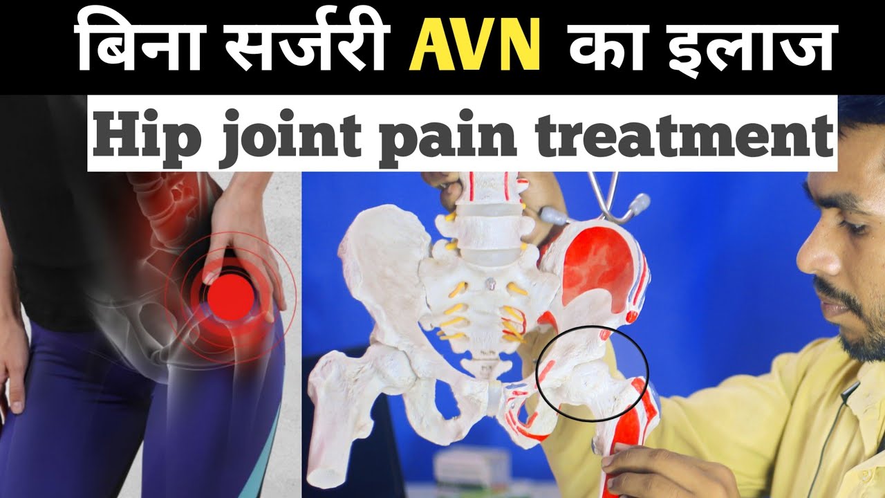 avn hip treatment without surgery || hip joint pain relief exercises, avascular necrosis, groin pain
