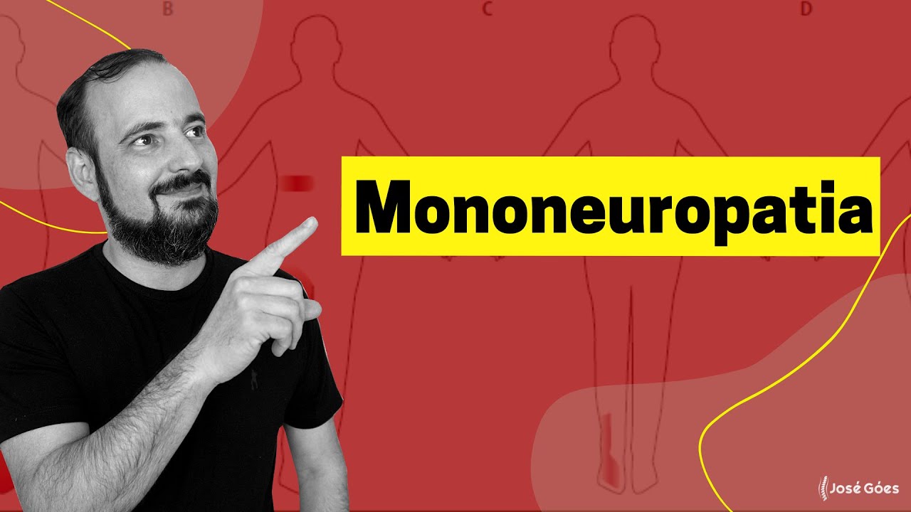 Mononeuropatia | Jos&eacute; G&oacute;es