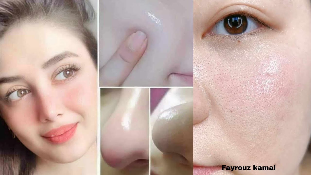 انظر ماذا فعل الماسك ببشرتي!! أبدو أصغر سنا إزالة البقع الداكنة + التجاعيد الكلف والمسام