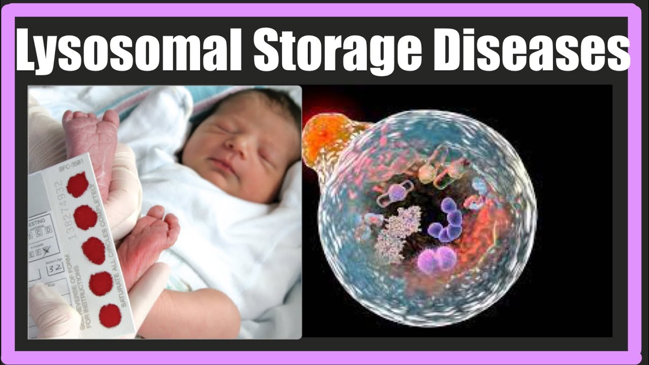 Lysosomal Storage Diseases Part 1 | Complete detail | Tay Sechs | Gyacheirs | Krabbes disease | Easy