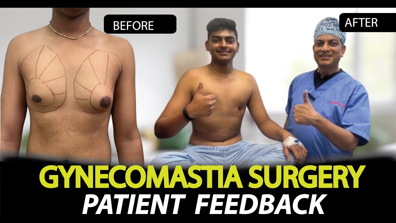 Gynecomastia Surgery in Jaipur | Best Gynecomastia Treatment by Dr. Deepesh Goyal