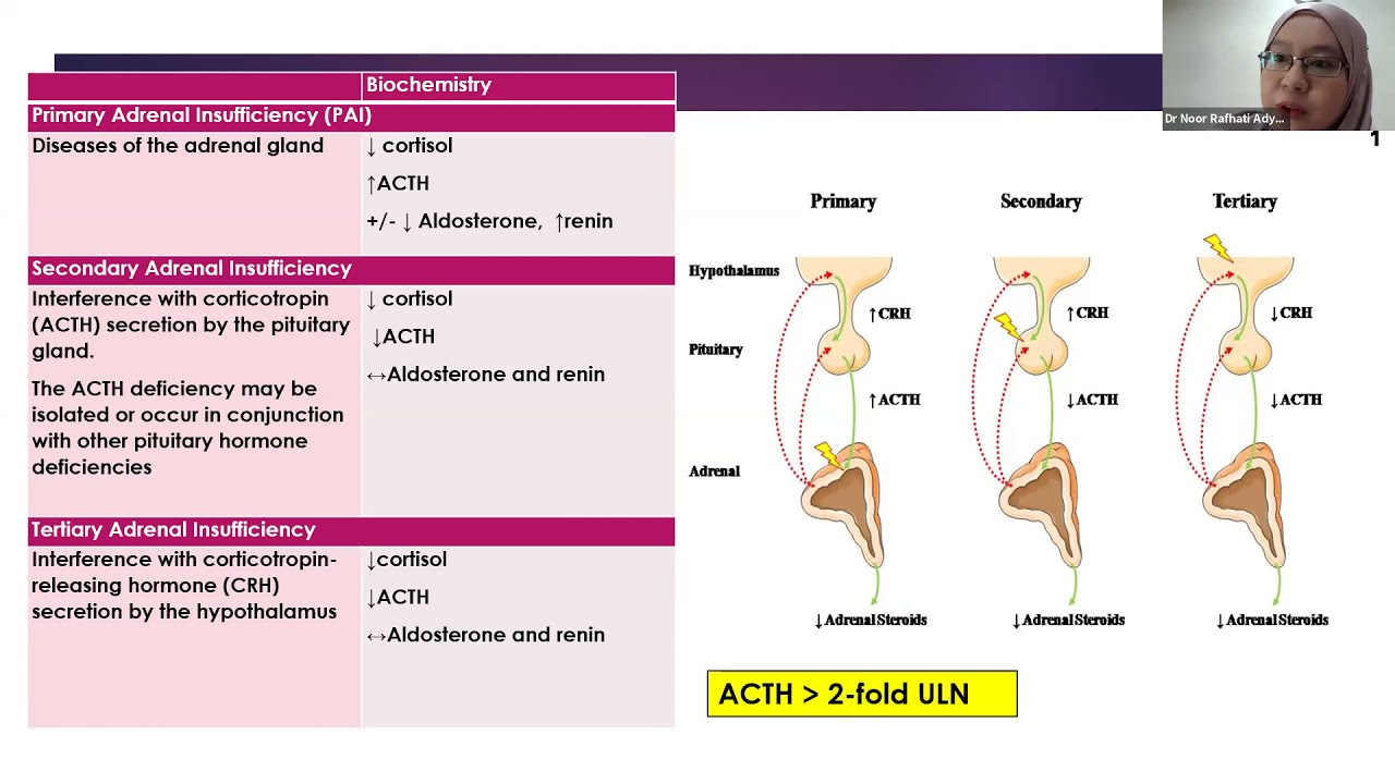 Endocrine week 2 - 12 8 2021 - Adrenal Insufficiency: When to Suspect, Interpreting synacthen test