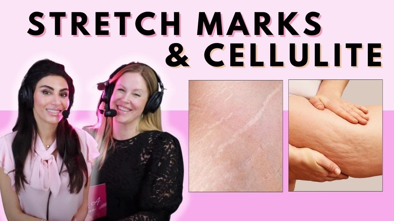 Stretch Mark REMOVAL, Cellulite TREATMENT & More! | More Than A Pretty Face Podcast