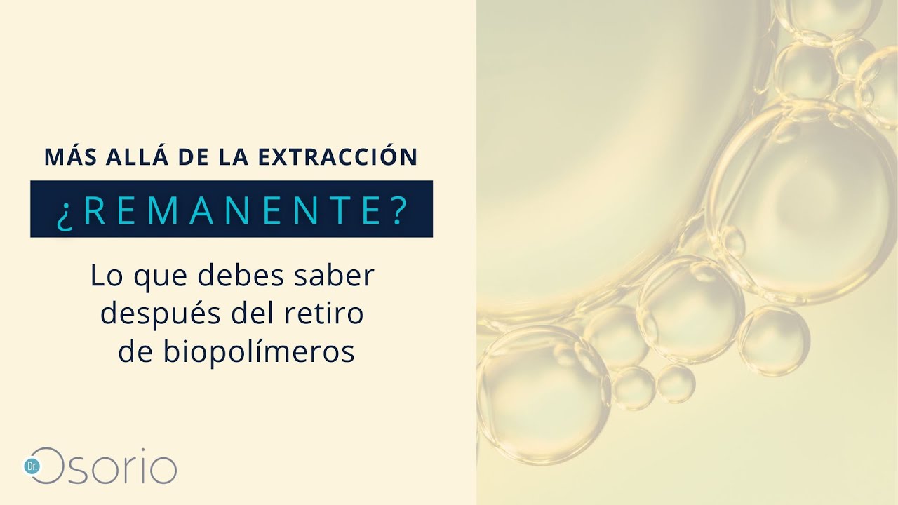 Remanente lo que debes saber después del retiro de biopolímeros