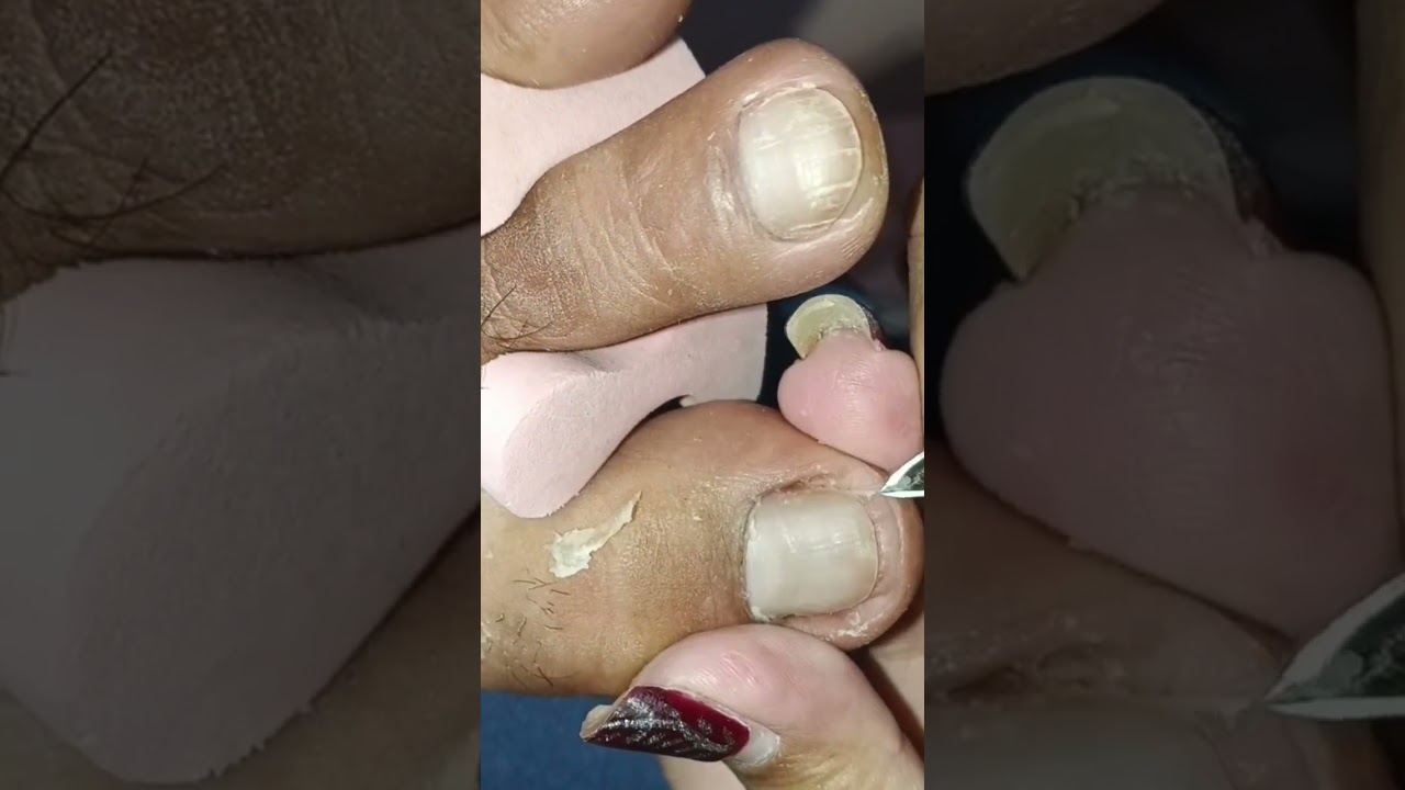 Full pedicure video, subscribe for more satisfying videos 😊
