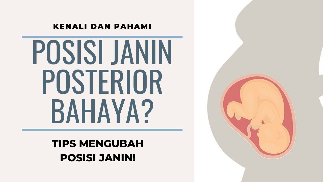 Cara Mengatasi Posisi Bayi Posterior :Tips Supaya Bayi Posterior Menjadi Anterior!
