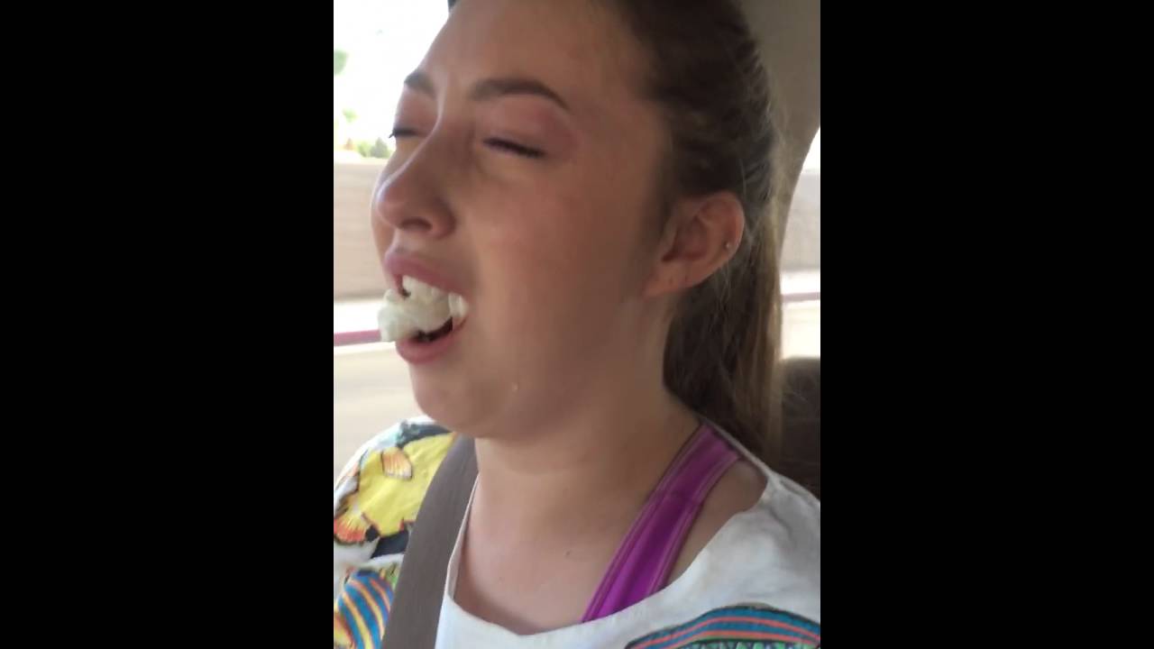 Evys wisdom teeth