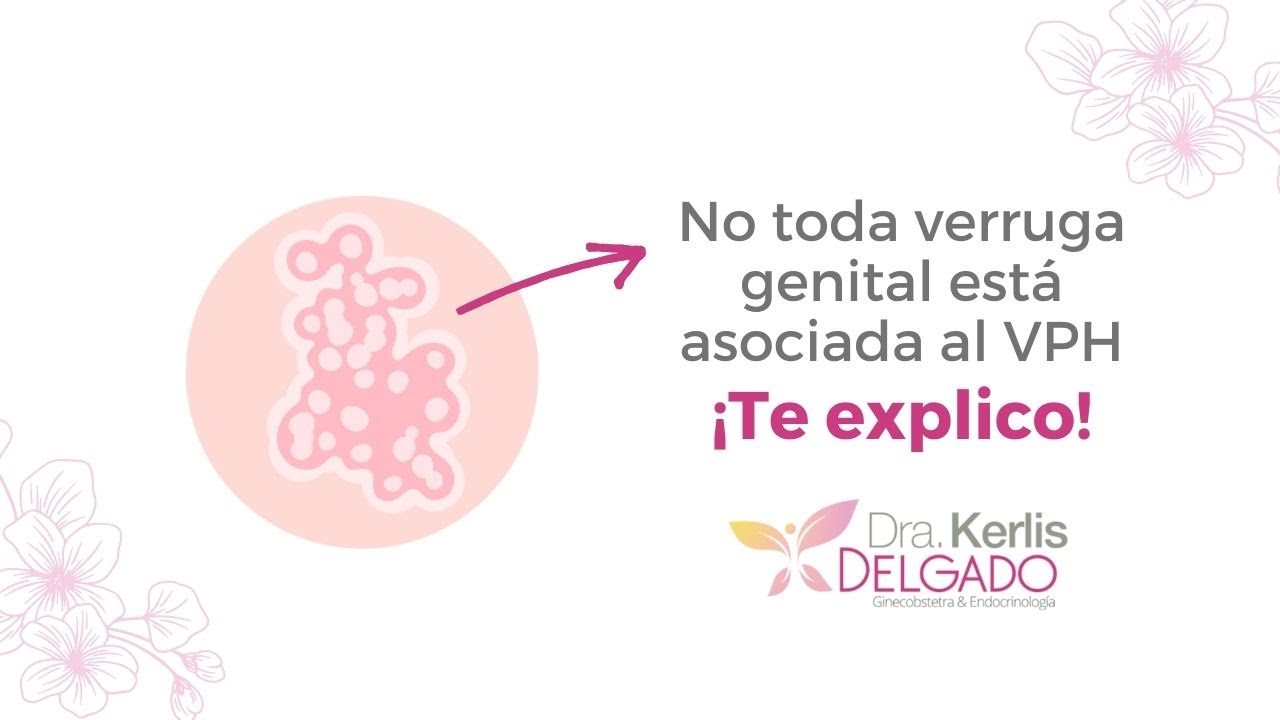 No toda verruga genital est&aacute; asociada al VPH. Te explico - Dra. Kerlis Delgado Ginec&oacute;loga