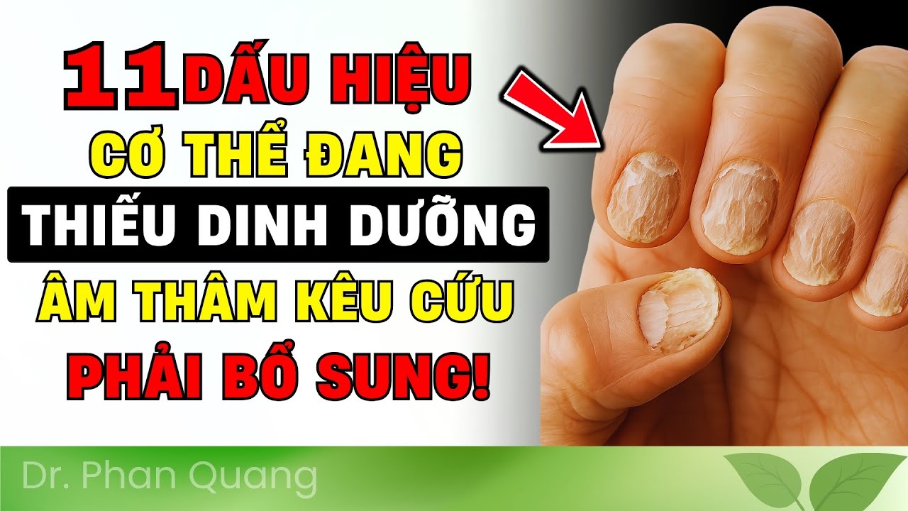 ⚠️ CẢNH BÁO! 11 DẤU HIỆU ĐỎ CƠ THỂ BẠN ĐANG THIẾU CHẤT DINH DƯỠNG NGHIÊM TRỌNG | Dr Phan Quang