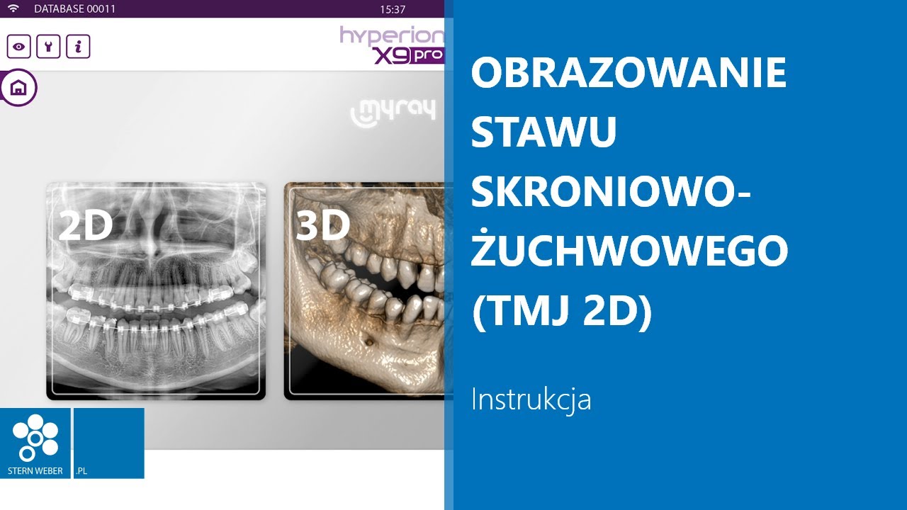 Obrazowanie stawu skroniowo-żuchwowego (TMJ 2D) | Instrukcja wykonywania badania w MyRay Hyperion X9