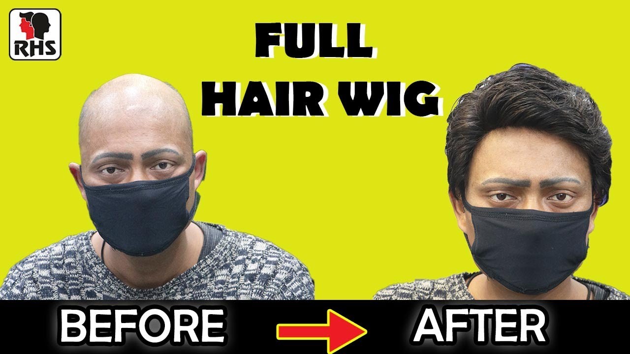 Full Hair Patch For Men In Delhi | Alopecia | Full Bald Hair Wig | Hair Coloring |Rizy Hair Solution