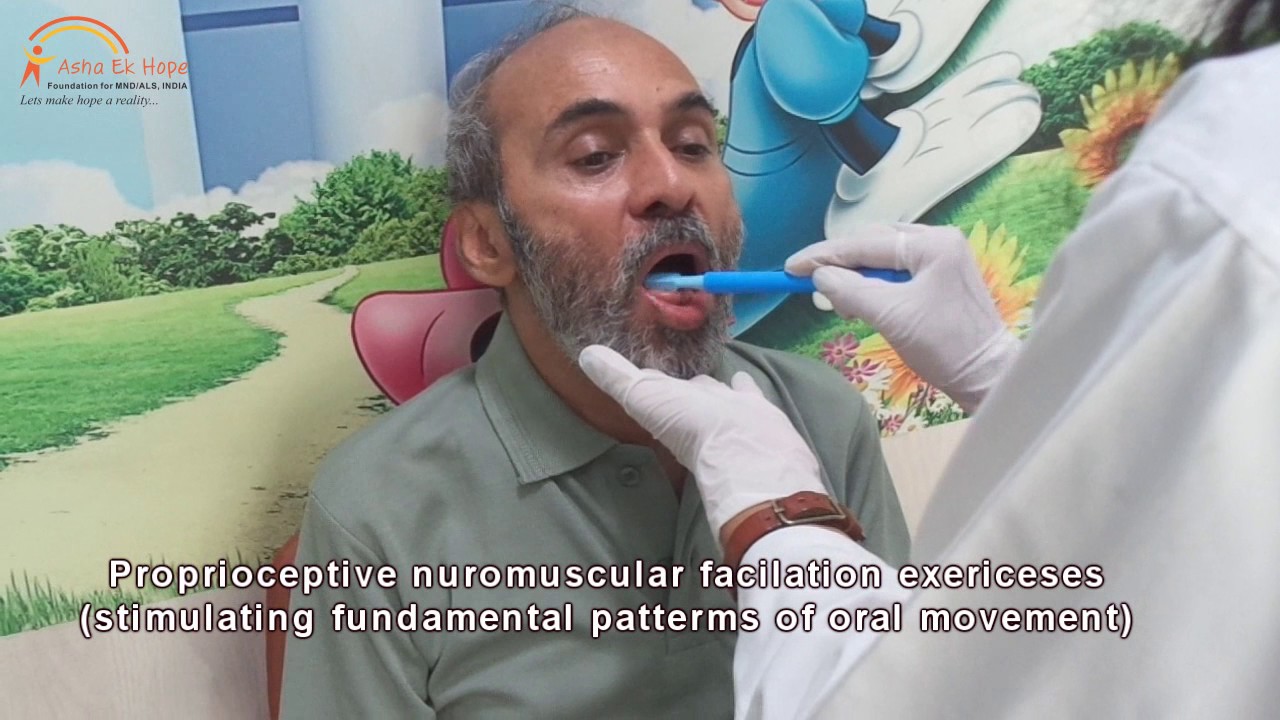 Speech Therapy for ALS and MND Patients