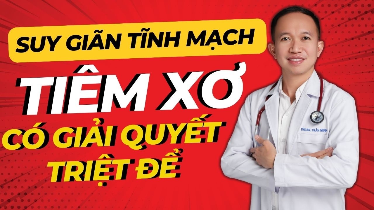 Suy Giãn Tĩnh Mạch Nặng Chân, Mất Ngủ – Tiêm Xơ Có Giải Quyết Triệt Để? | Bác Sĩ Trần Minh