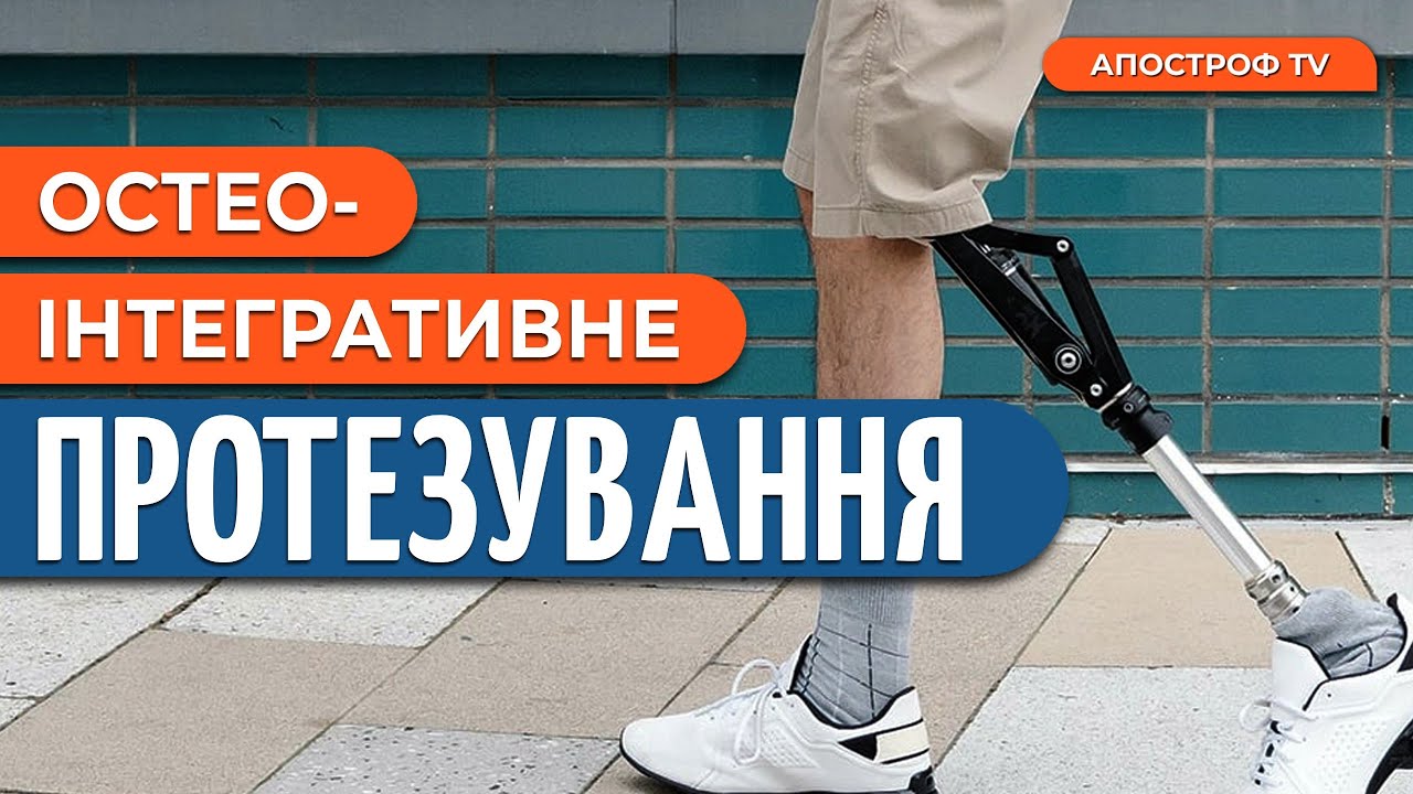 🦿ІННОВАЦІЙНЕ протезування для захисників з ВАЖКИМИ ампутаціями