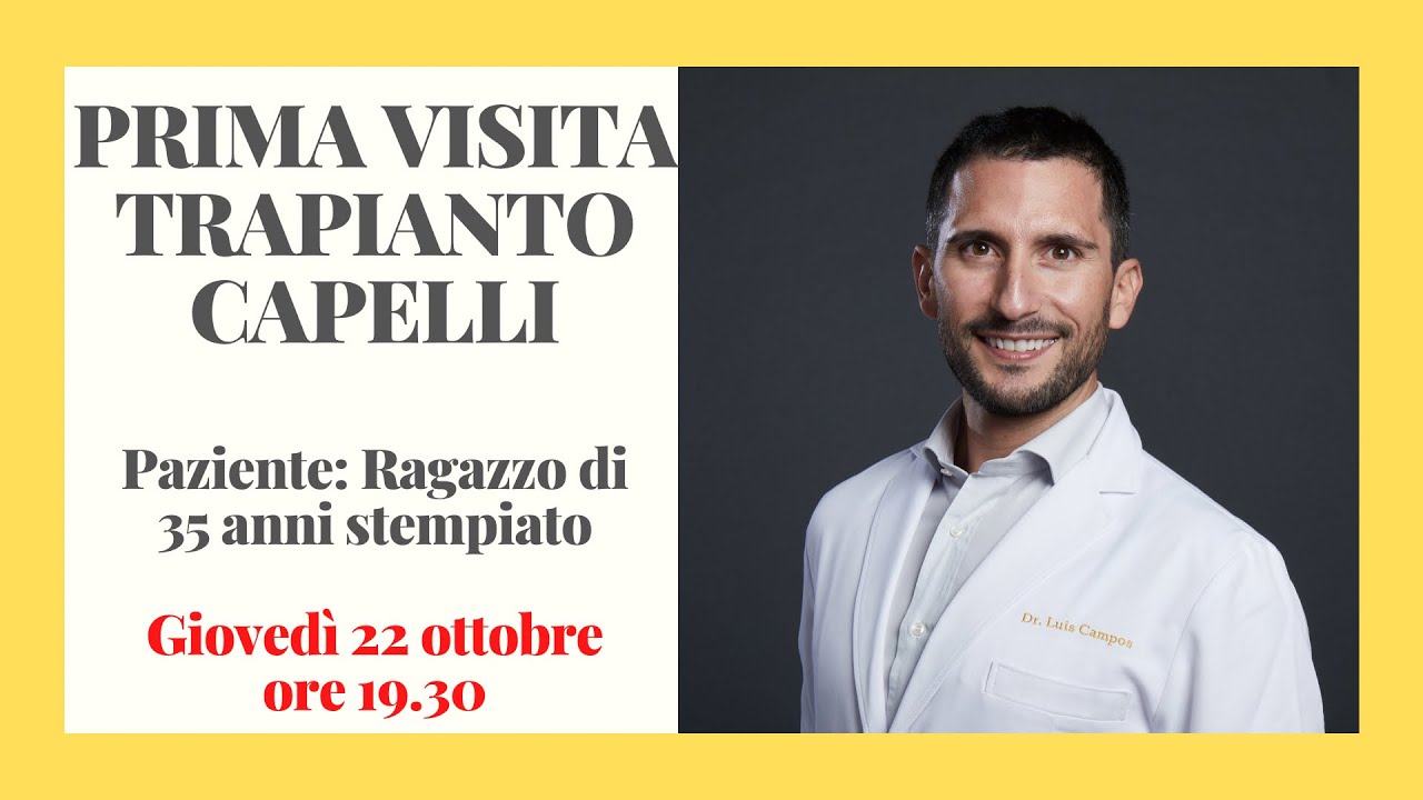 PRIMA VISITA TRAPIANTO CAPELLI Ragazzo di 35 anni stempiato