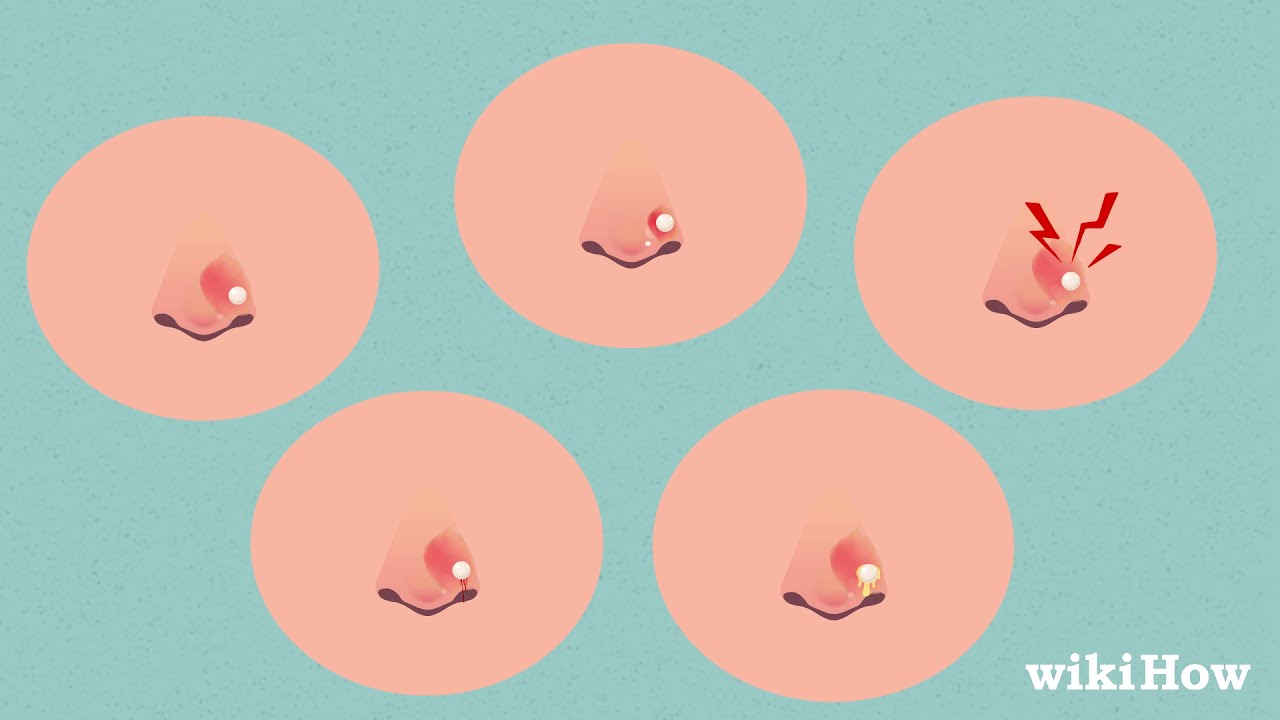 How to Clean Your Nose Piercing