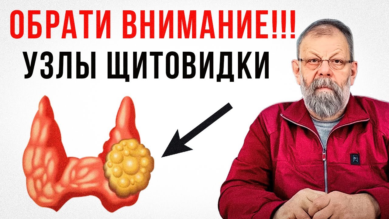 Узелки в щитовидной железе. Объяснение доктора медицинских наук.