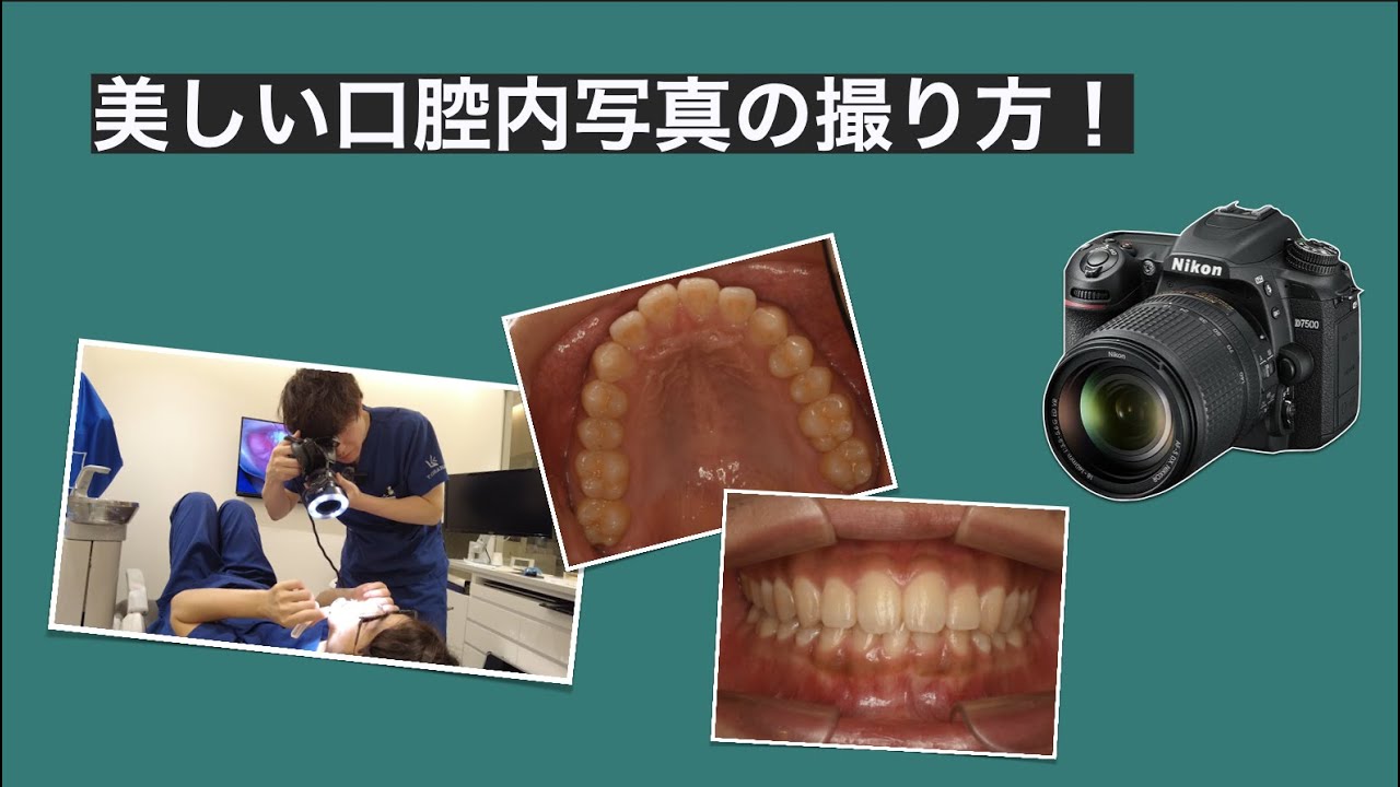 3つのコツで完璧！口腔内写真の撮り方全て解説！