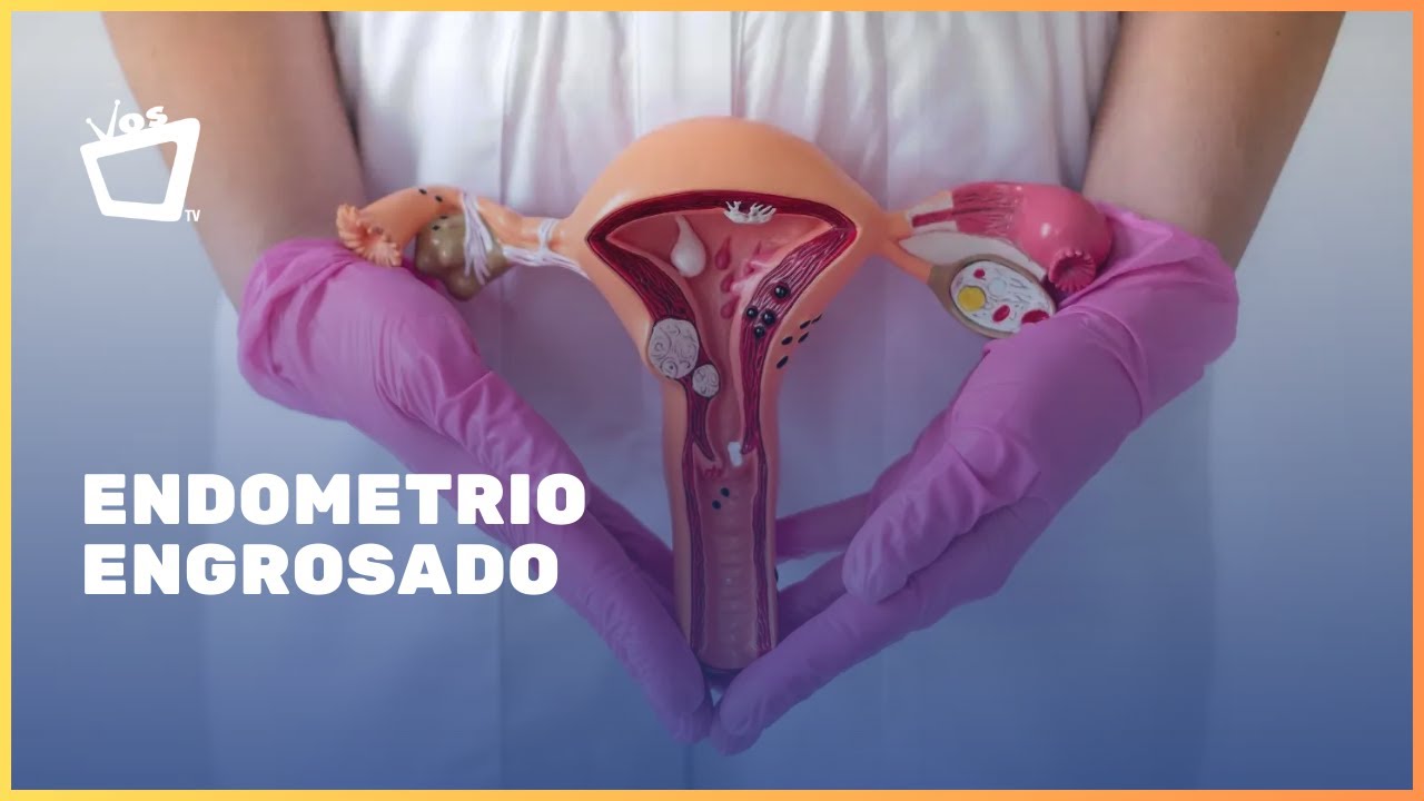 Endometrio engrosado | Lo que necesitás saber