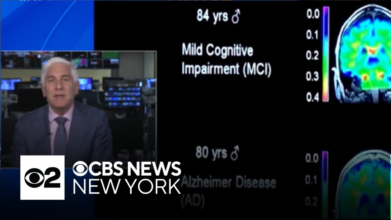 Dr. Jon LaPook talks about the latest developments in the fight against Alzheimer&rsquo;s