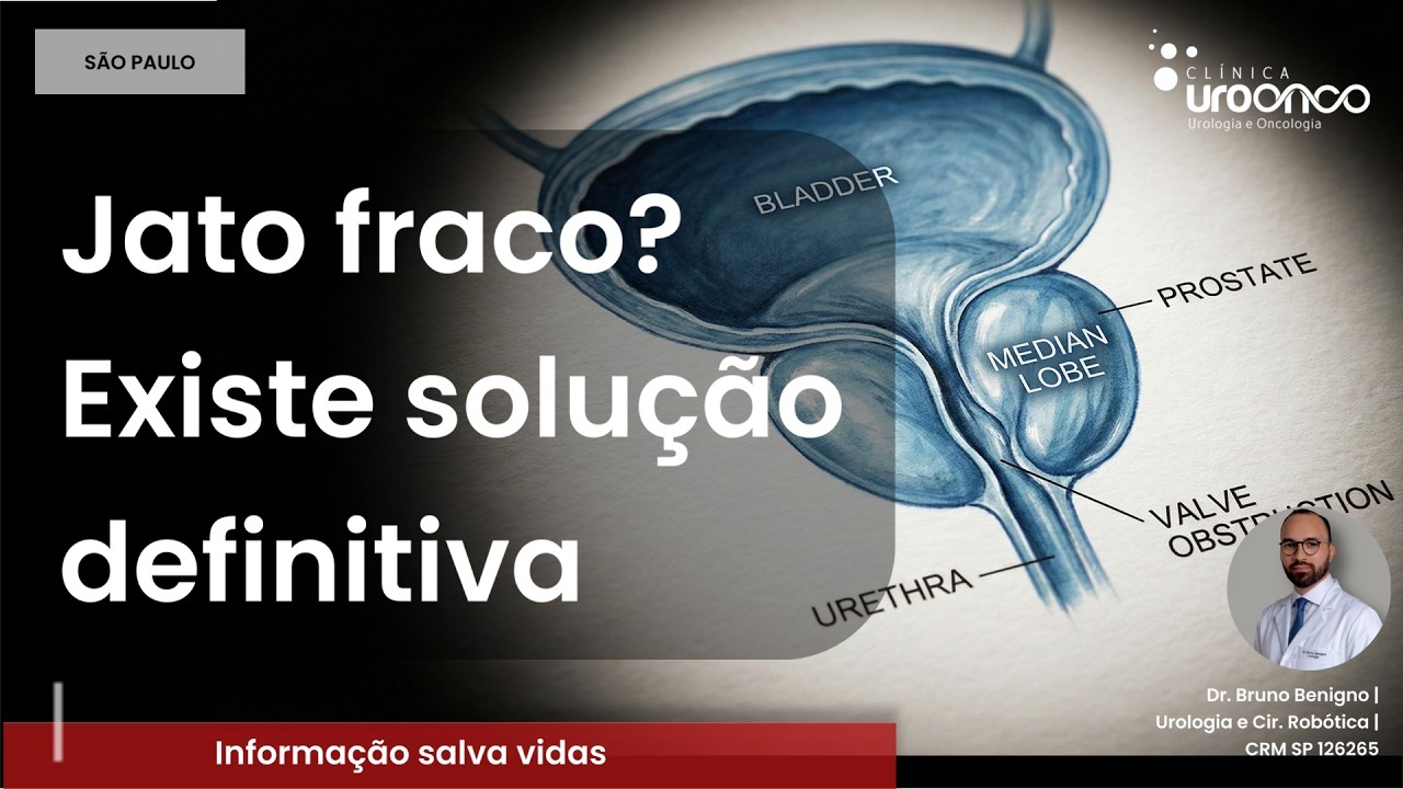 BANHEIRO a cada 2 HORAS? O erro que ESTRAGA sua BEXIGA — e como o HoLEP RESOLVE