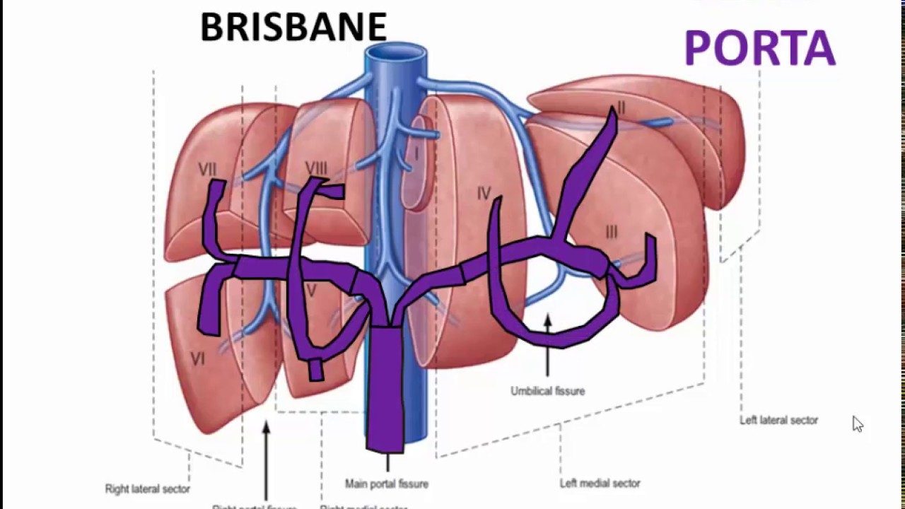 Segmentación Hepática 1 - BRISBANE 2000