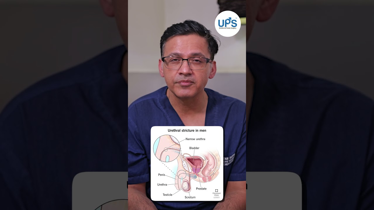 Most Challenging Urethroplasty Case