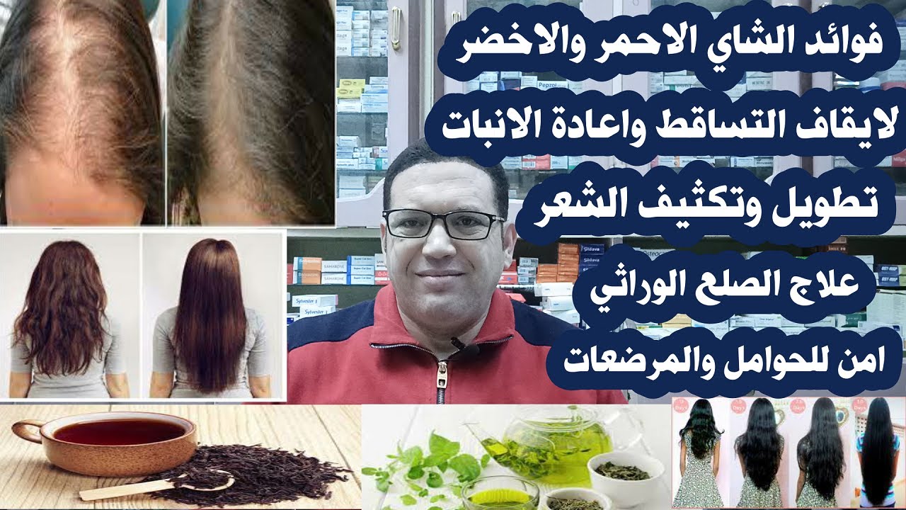فوائد الشاي الاحمر والاخضر لايقاف التساقط واعادة الانبات وتطويل وتكثيف الشعر وملئ فراغات فروة الراس