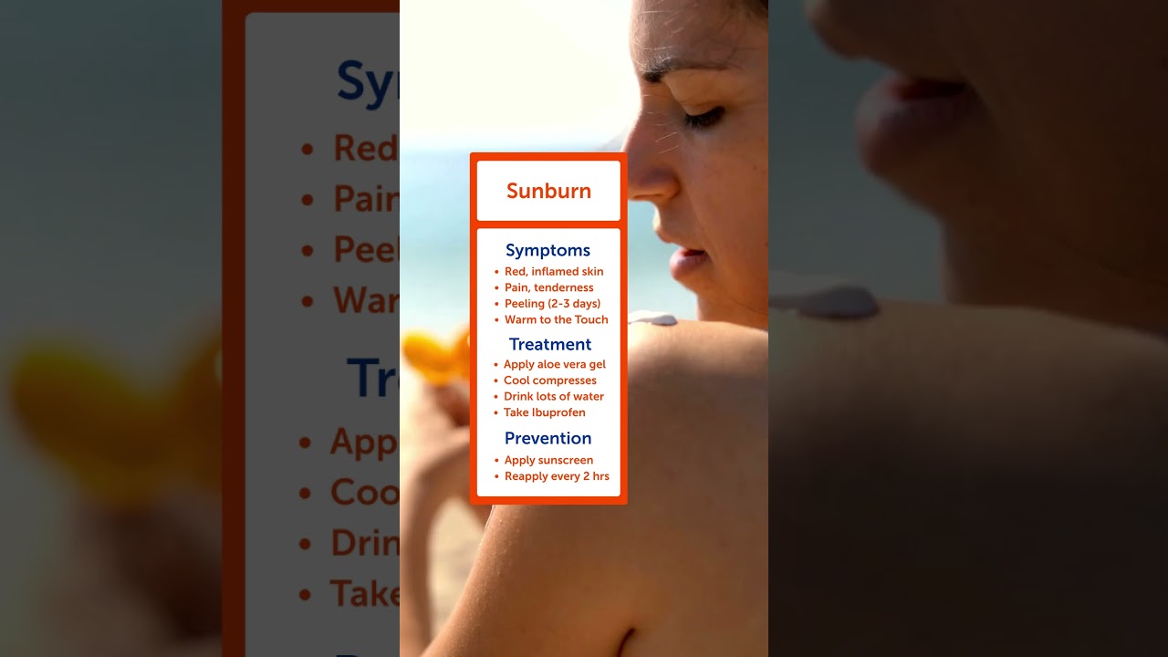 Is It a Sunburn or Worse? ☀️ Sunburn vs. Sun Poisoning vs. Heat Rash | Summa Health