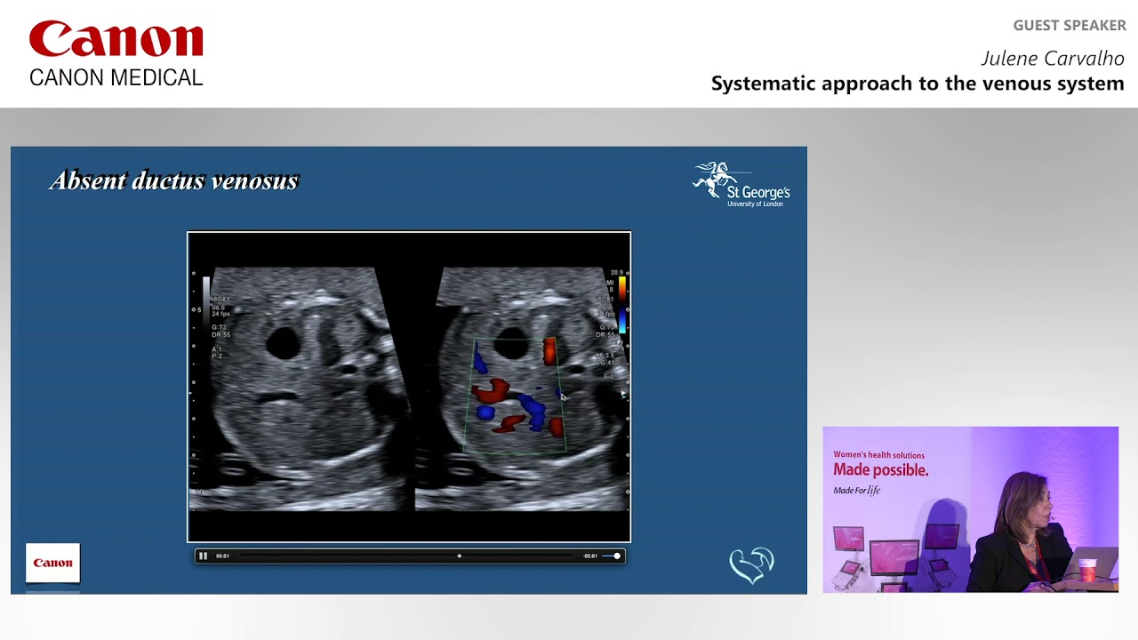 ISUOG 2019 - Julene Carvalho on a systemic approach to the venous system