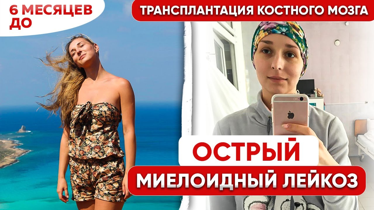 Я думала, это просто простуда... Моя история борьбы с Лейкемией