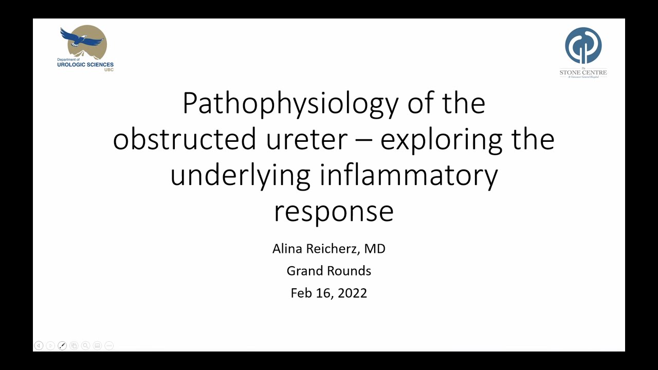 Pathophysiology of the Obstructed Ureter – Exploring the Underlying Inflammatory Response