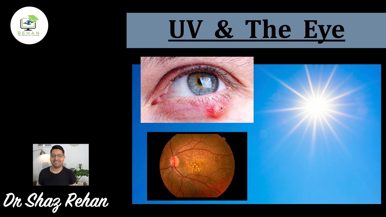 How can Ultraviolet (UV) Light Affect the Eye? Dr Shaz Rehan, 2021